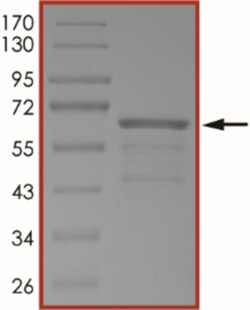 Sino Biological&nbsp;Recombinant Human Tau Protein (Tau-441), CAMK2-phosphorylated